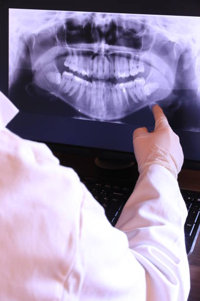Best Emergency Root Canal Treatment in Millersburg, OH